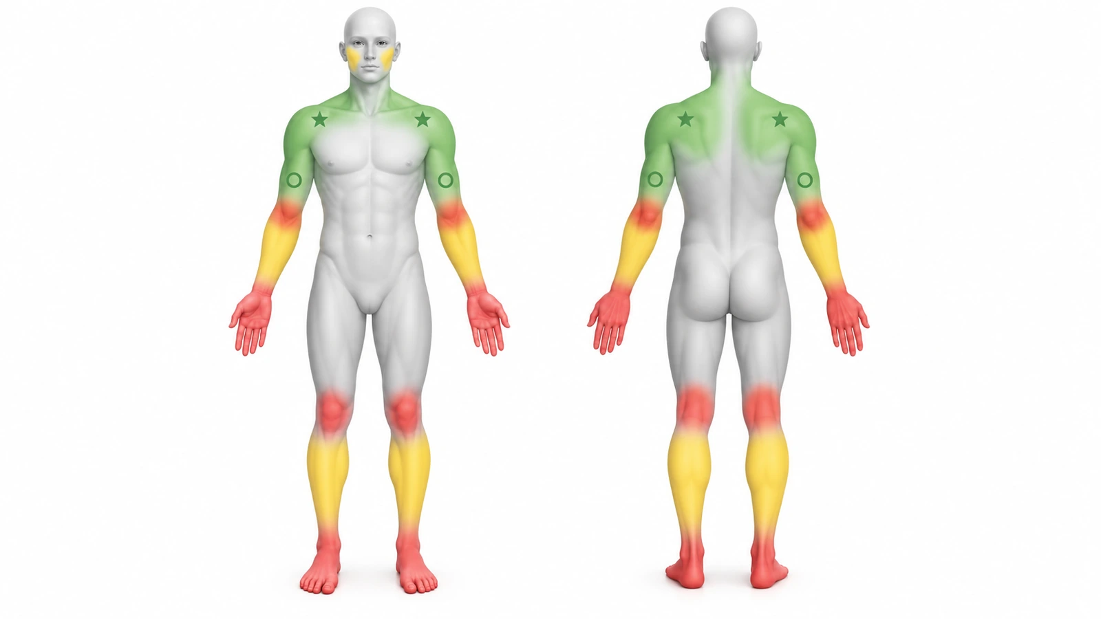 Front and back body silhouettes color-coded green on shoulders, upper back and inner forearms, yellow on outer forearms and calves, and red on hands, fingers, wrists, elbows, knees and feet